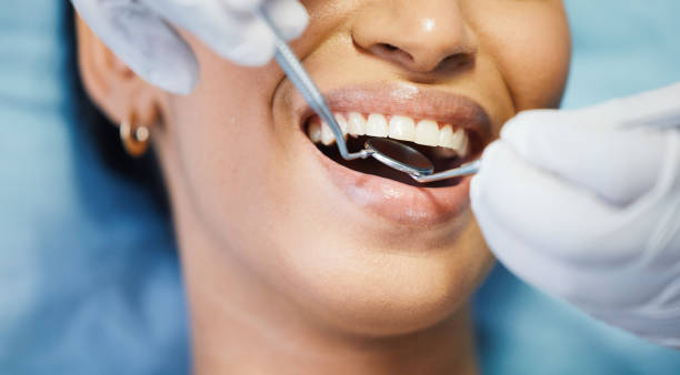 Best Urgent Dental Care for Toothaches in National City, CA